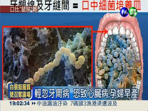 刷牙不徹底 比老鼠屎髒8倍!