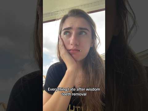 what I ate after my wisdom teeth removal