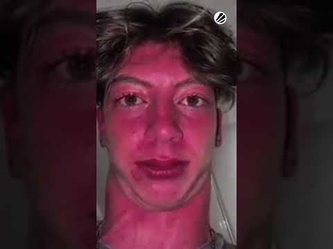 Unstoppable Force vs Immovable Yatoro 🗿 - ESL Dota 2