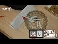 Dr. G: Medical Examiner - Season 2, Episode 2 - The Mourning After - Full Episode