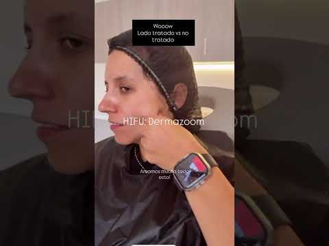 video AdmX9JQllNI