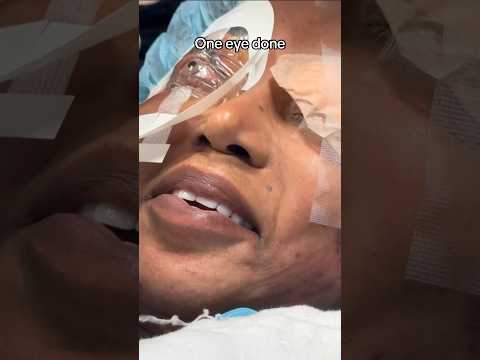 Eye Color Change with ColorEyes procedure