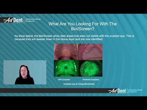 How Bio/Screen Oral Exam Light helps grow your practice   #addent
