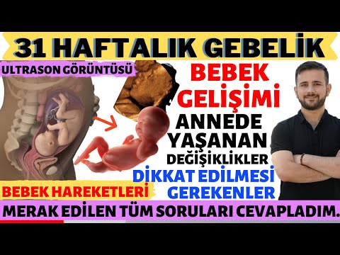 31 Weekly Pregnancy (2020)