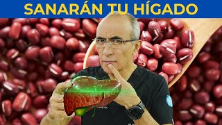 🧽 5 Alimentos Poderosos que Limpiarán tu Hígado Graso