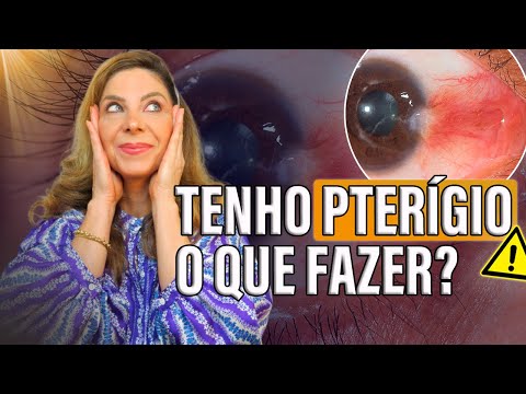 Como Prevenir e Tratar o Pterígio nos Olhos?