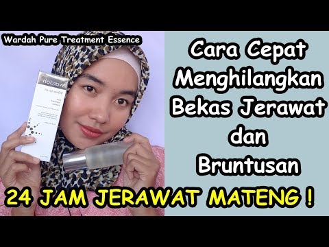 download lagu mp3 mp4 Cara Menghilangkan Bekas Jerawat Wardah, download lagu Cara Menghilangkan Bekas Jerawat Wardah gratis, unduh video klip Cara Menghilangkan Bekas Jerawat Wardah
