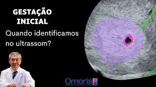 Early pregnancy: When is it possible to identify pregnancy on ultrasound?