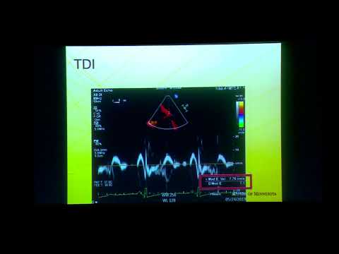 20190829_17_LV diastolic function_Dr Sudarshan Setty
