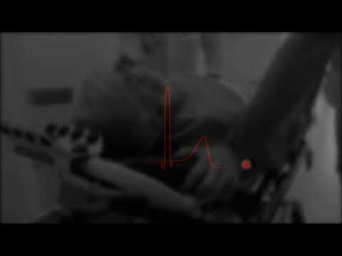 FRANKOFFSKY - STANY LĘKOWE PROD. ESKRY