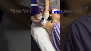 Diode laser hair removal day! #skinstation #hairremoval #bodycare #hair