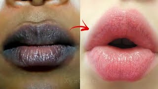 काले होंठो को गुलाबी मुलायम बनाये सिर्फ 5 मिनट के अंदर - Get Baby Soft Pink Lips in just 5 Minute video