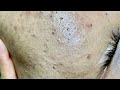 Satisfying Video With Chung Vo Spa 379