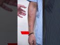 Lipoma Removal Lipoma Lipoma Cost Lipoma Short Short Shortvideo
