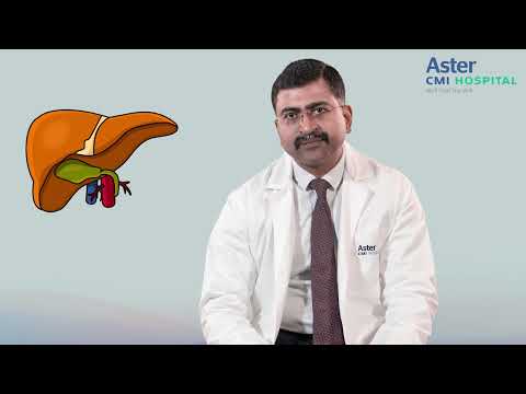 Gall bladder stones : Causes and Treatment | Dr. Mahesh Chikkachannappa | Aster CMI Hospital