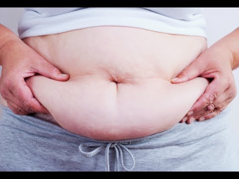 Kung paano mawalan ng 10 kg sa isang linggo sa bahay na may walang video diets Mawalan ng timbang kung dahil sa sigarilyo