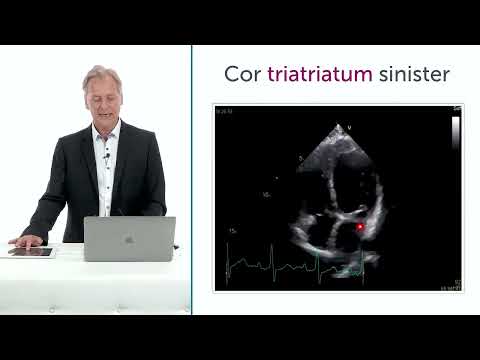 What left heart congenital problems can cause pulmonary hypertension?