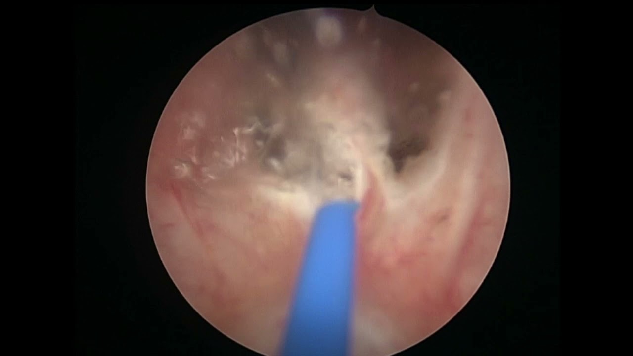 Miguel Angel Rodríguez Cabello-14