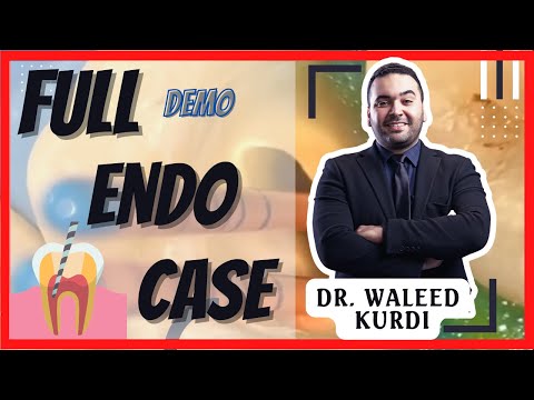 Demo | How to do a Root Canal Treatment