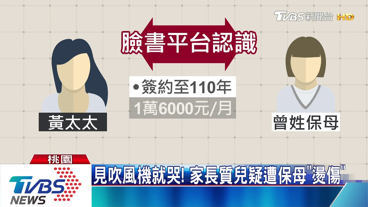 1歲兒身上「網狀烙印」　家長首出面控訴保母