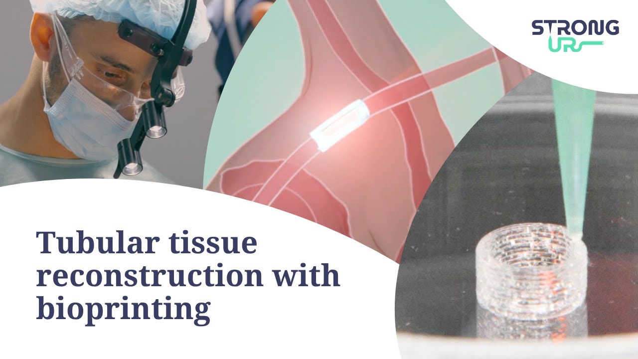 Revolutionising tissue reconstruction with bioprinting