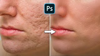 How To Fix Acne Scars or Wrinkles Fast | Photoshop Tutorial