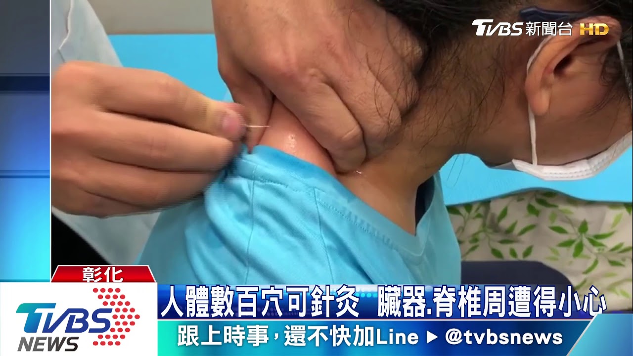 人體數百穴可針灸 臟器、脊椎周遭得小心