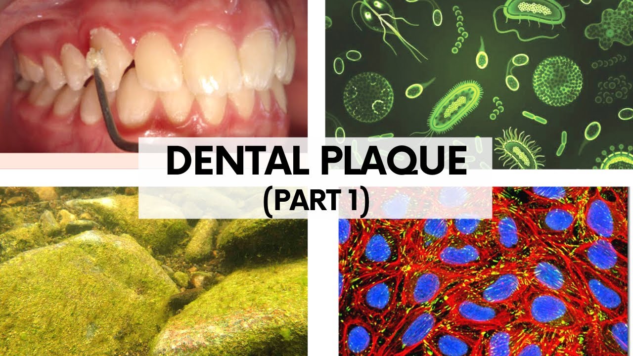 DENTAL PLAQUE ( Part 1) II Plaque as a Biofilm, Composition & Classification.