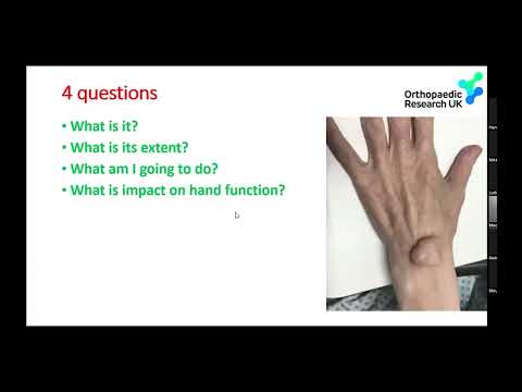 Diagnostyka obrzęków i guzków w dłoni i nadgarstku