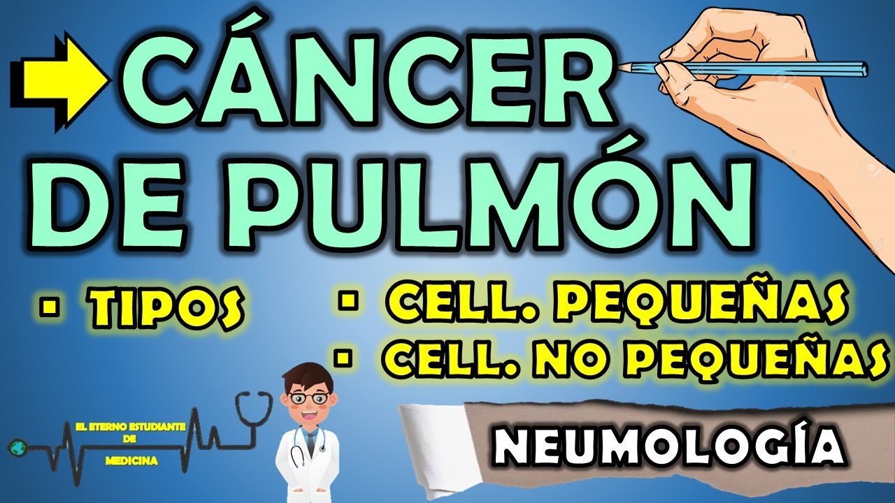 TIPOS DE CÁNCER DE PULMÓN NEUMOLOGÍA RESUMEN 📝👨🏻‍⚕️