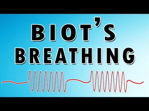 Biot's Cheyne-Stokes Respiration: A Window into Neurological Health