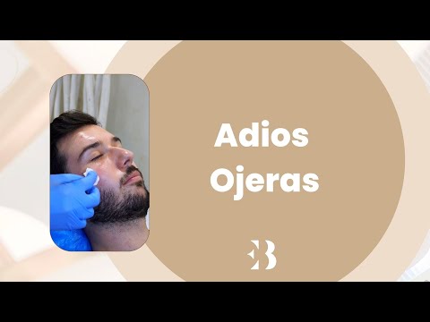 Adios Ojeras | Elena Berezo