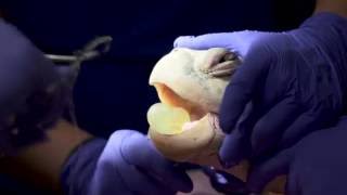 Rescued Sea Turtle, Weasley Undergoes Fishing Hook Removal Surgery