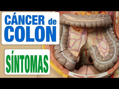 Cáncer de Colon - Síntomas