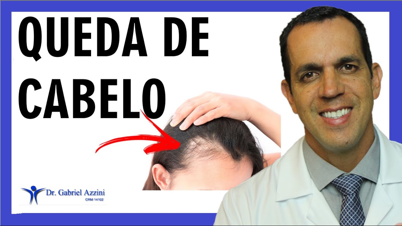 CAUSAS DE QUEDA DE CABELO - O QUE PODE SER? | Dr. Gabriel Azzini