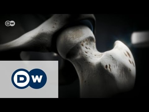 Ein Volksheilmittel für die Behandlung von Hüfte Verstauchung der Kniebänder, welcher Arzt
