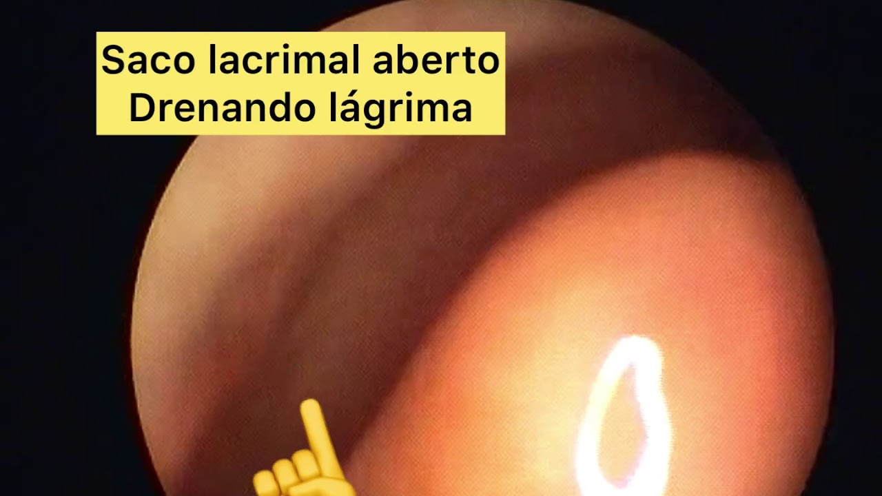 Rogério Poli Swensson-19