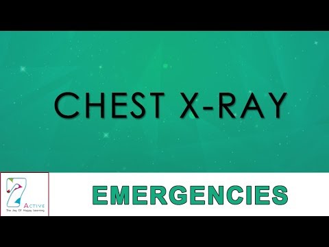 CHEST X-RAY