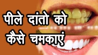 पीले दांतो को कैसे चमकाएं । How to brighten and whiten yellow teeth | Ms Pinky Madaan