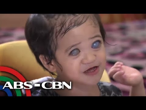 Isang ratio ng protina carbs taba diyeta Gusto kong magbawas ng timbang sa internet