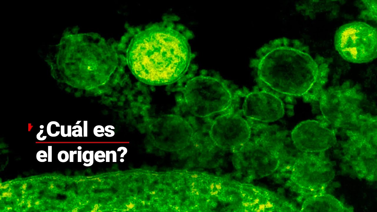Entrevista exclusiva: Experto revela detalles sobre los casos de Klebsiella oxytoca