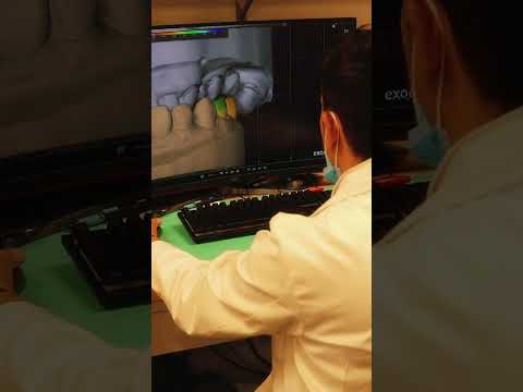 CAD/CAM Dentistry done right ✅