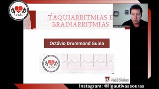Taquiarritmias e Bradiarritmias com Dr Octávio Drummond Guina