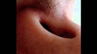 The Residents - Moose