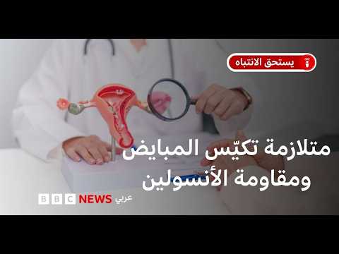 لماذا تغيّر اسم متلازمة تكيّس المبايض من PCOS إلى PMOS؟ في هذه الحلقة من بودكاست يستحق الانتباه، تشرح الدكتورة بيان مصطفى الهنداوي أسباب هذا التغيير، وما يعنيه لفهم الحالة وتشخيصها وعلاجها، وانعكاس ذلك على صحة ملايين النساء حول العالم.. 