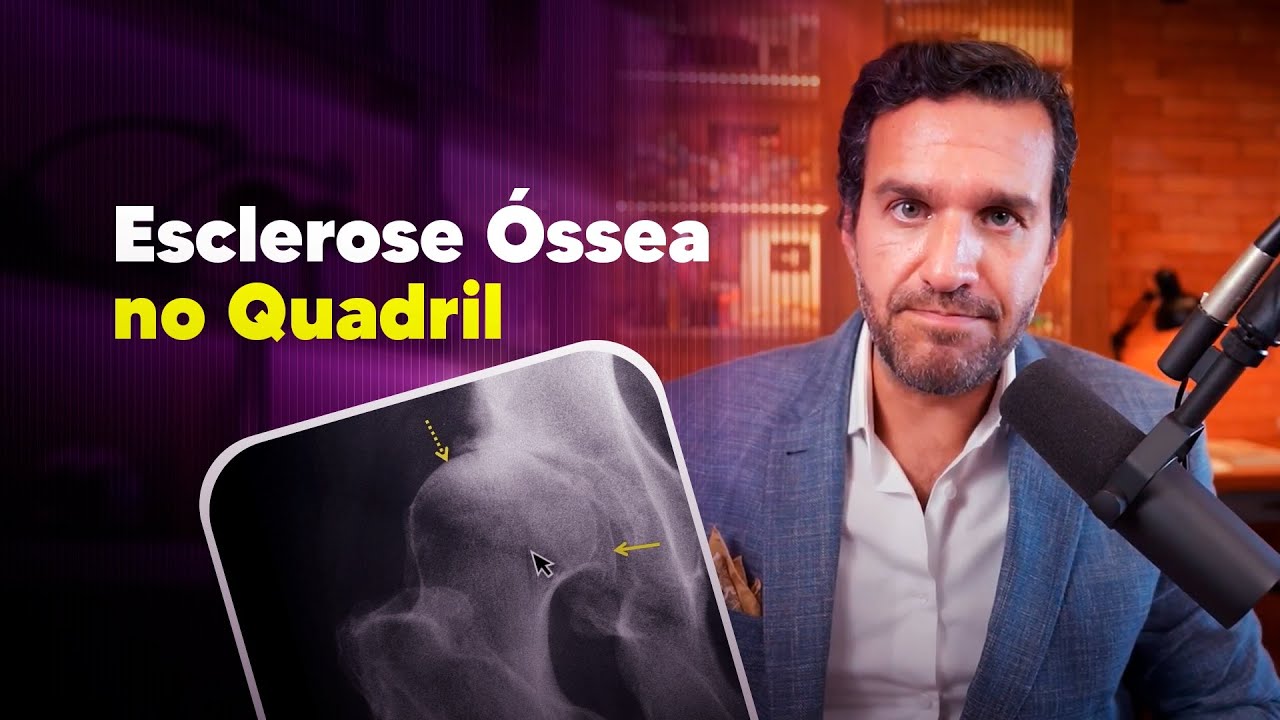 Esclerose óssea no quadril, o que é isso? - Dr. David Gusmão