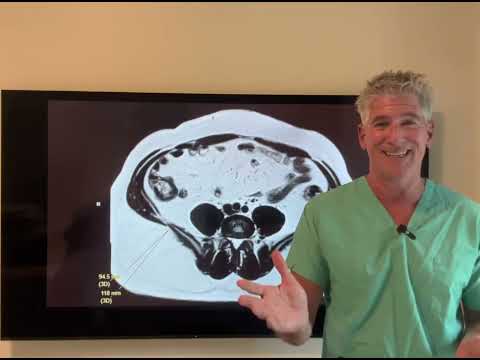 Are 6 Pack Abs Maybe BAD for  You Actually? Dr. Sean Tells You Want You Need to Know!