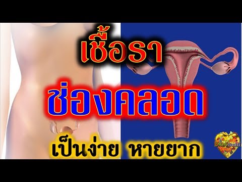 เชื้อโรคหญิงในหยดในโซซี ผลกระทบใน sportpit แรง
