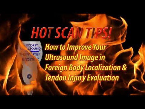 Hot Tip -How to Improve Your Ultrasound Image in Foreign Body Localization and Tendon Injury Eval.