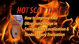 Hot Tip -How to Improve Your Ultrasound Image in Foreign Body Localization and Tendon Injury Eval.